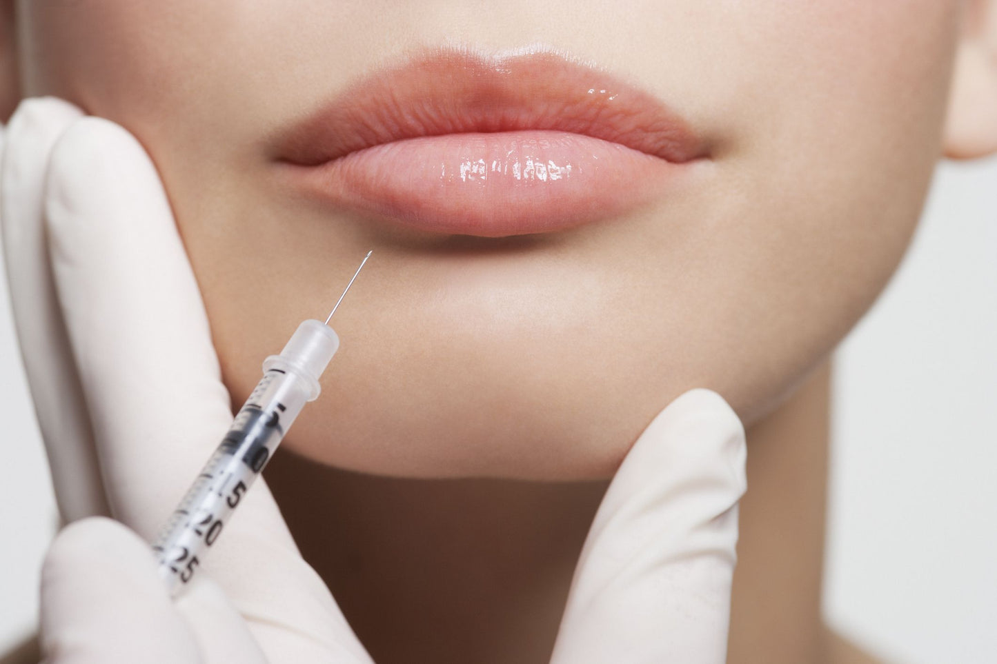 Lip Augmentation (1.1ml)